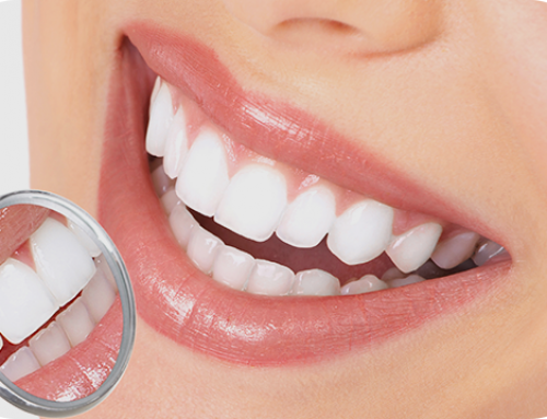 Types of Cosmetic Dental Care in Scottsdale, AZ