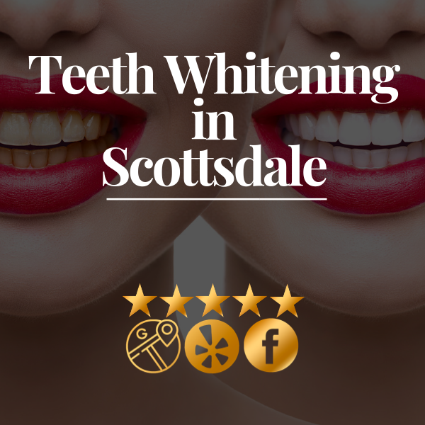 Affordable Scottsdale Teeth Whitening Scottsdales Cosmetic Dentist