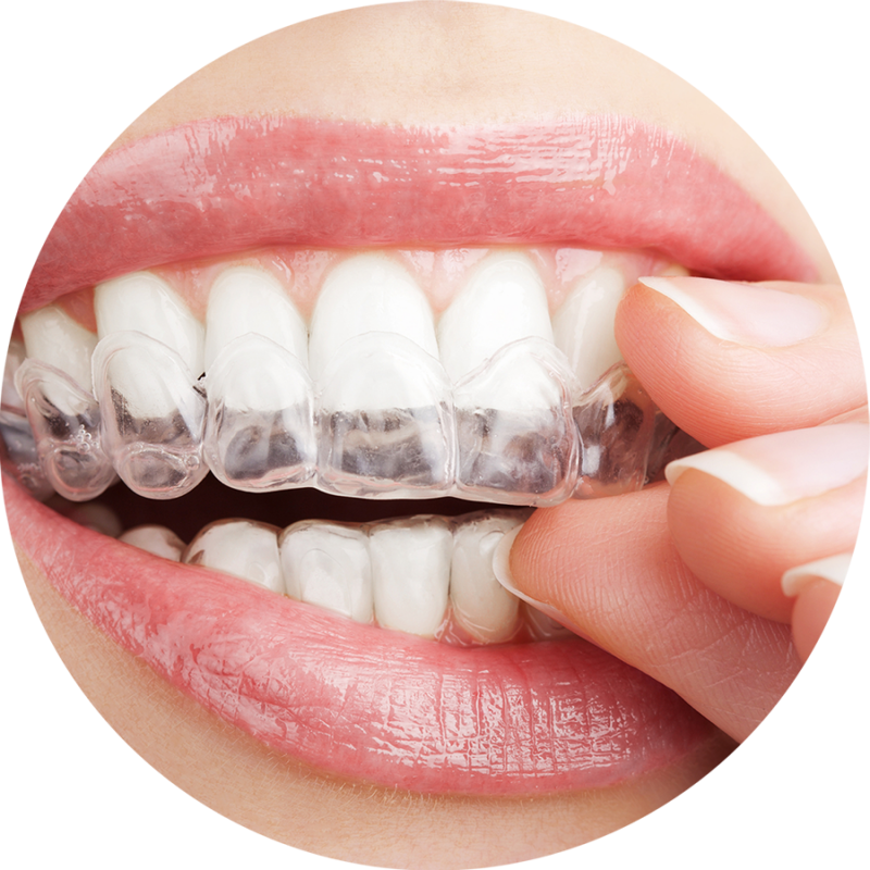 Affordable Scottsdale Braces And Invisible Braces Scottsdales Dentist